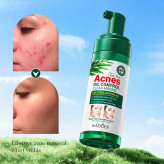 ⭐️موس پاککننده کنترل آکنه پوستهای جوشدار سادور با روغن درخت چای