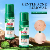 ⭐️موس پاککننده کنترل آکنه پوستهای جوشدار سادور با روغن درخت چای